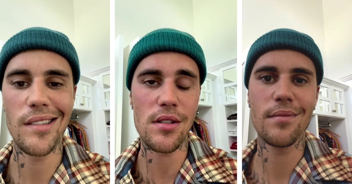 Como o rosto de Justin Bieber melhorou depois de sofrer de paralisia facial?