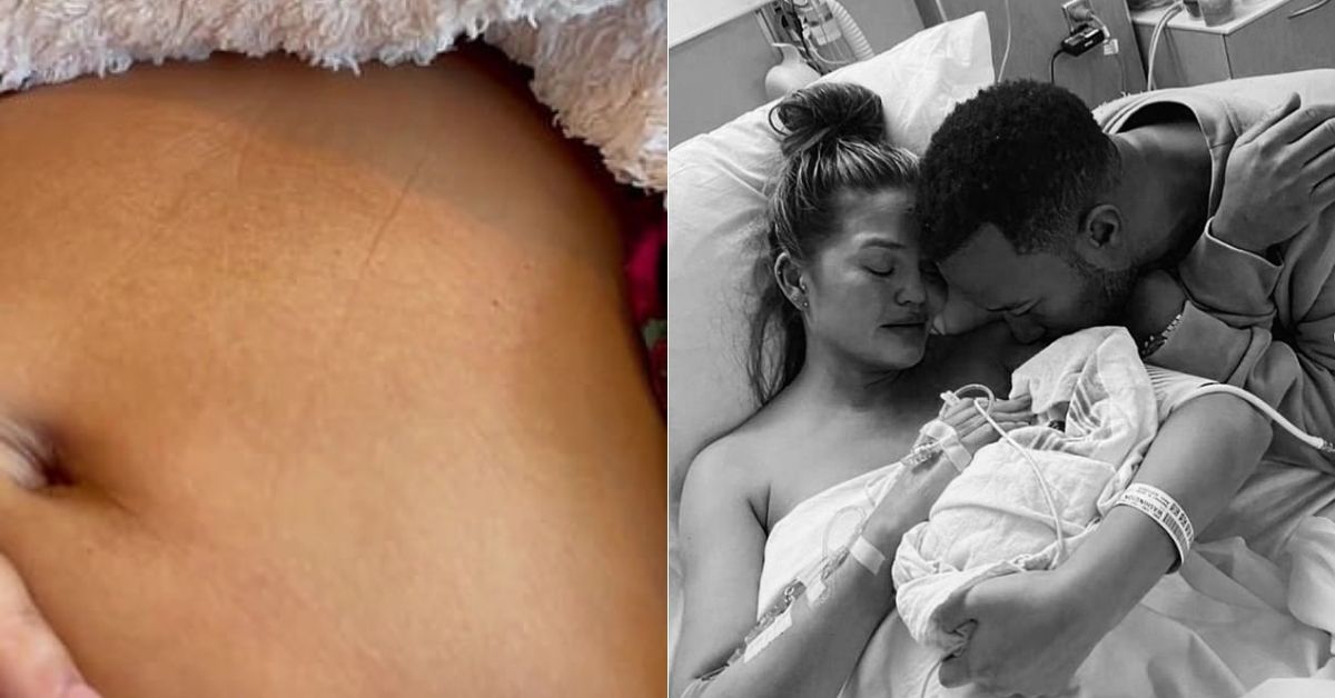Os fãs de Chrissy Teigen enviam seu amor enquanto ela marca o fim da semana do nascimento do bebê Jack