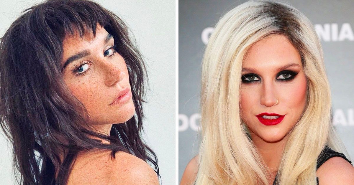20 fotos surpreendentemente lisonjeiras de Kesha