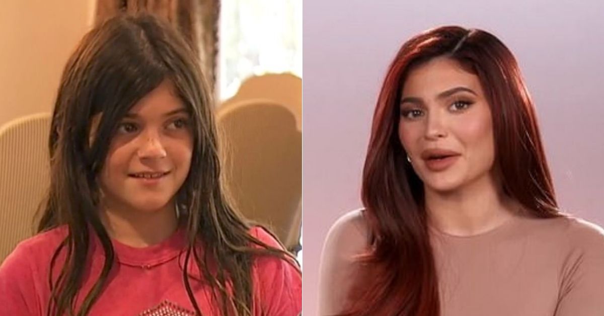 Os fãs de Kylie Jenner dizem que estão ‘preocupados’ com a aparência dela em 10 anos