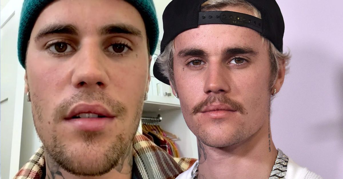 Como o rosto de Justin Bieber melhorou depois de sofrer de paralisia facial?