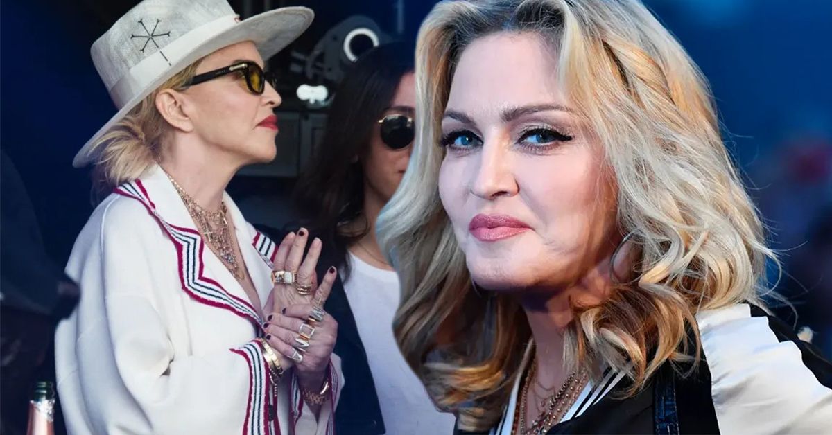 Os fãs ainda estão confusos com a escolha de Madonna de usar um tapa-olho