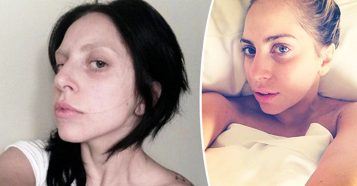 15 fotos de Lady Gaga sem maquiagem