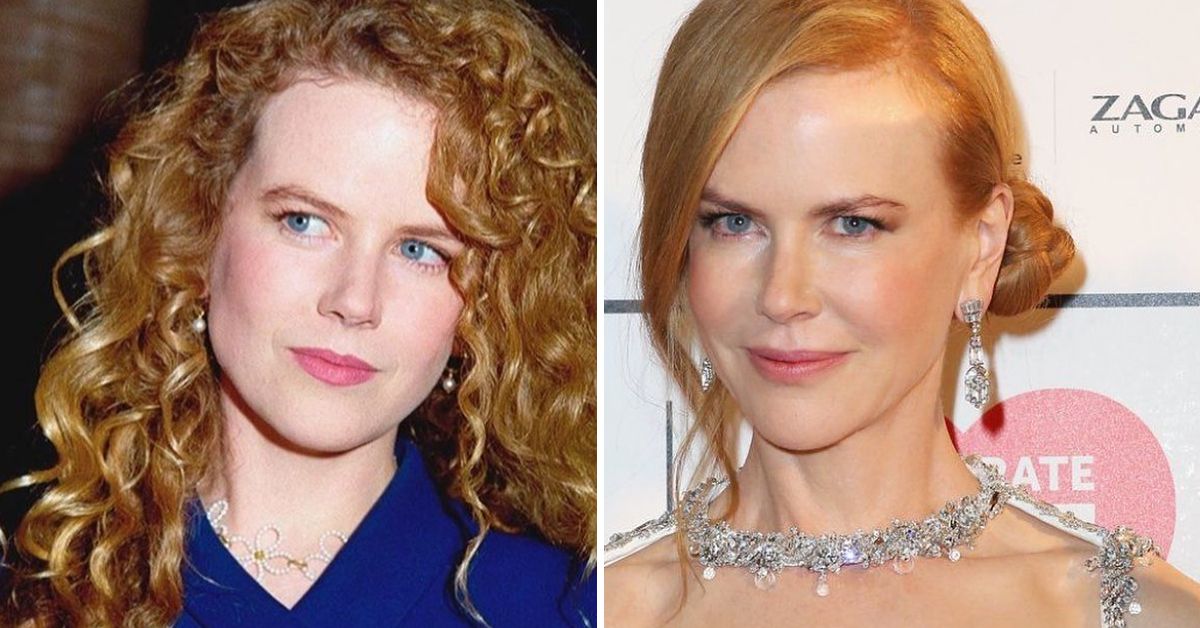 Que mudanças Nicole Kidman fez em seu rosto?