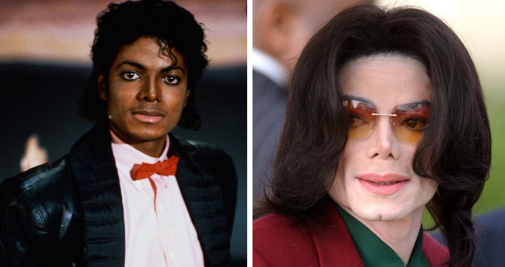 A verdade por trás de todas as cirurgias plásticas de Michael Jackson