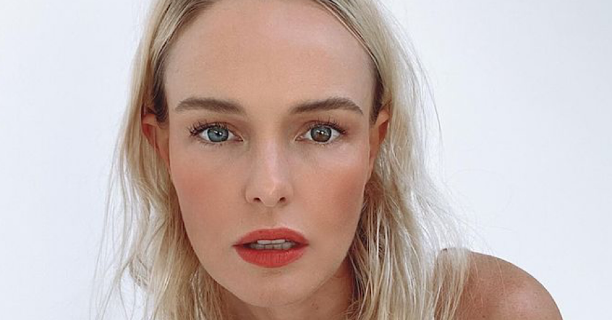 Veja por que Kate Bosworth tem dois olhos de cores diferentes