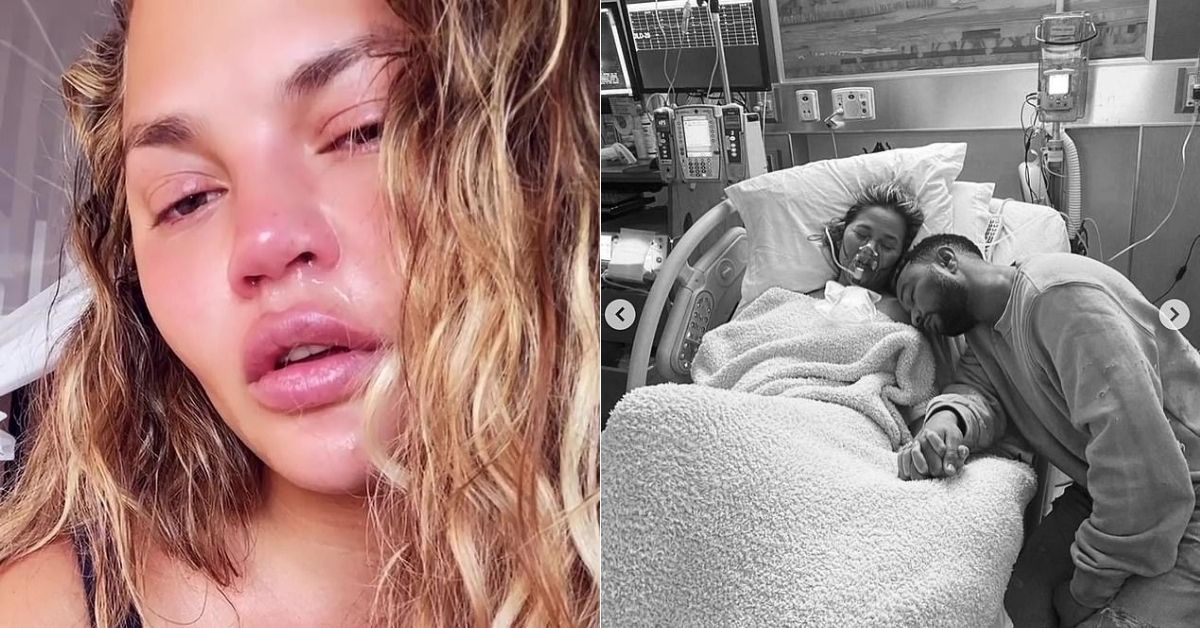 Os fãs de Chrissy Teigen a chamam de 'valente' depois que ela compartilha 'cara de choro pós-terapia'